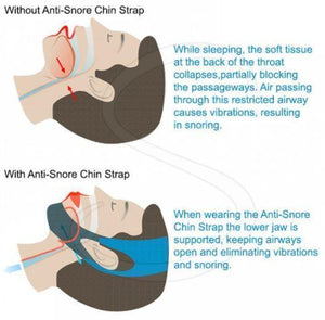 Anti-Snoring Chin Strap